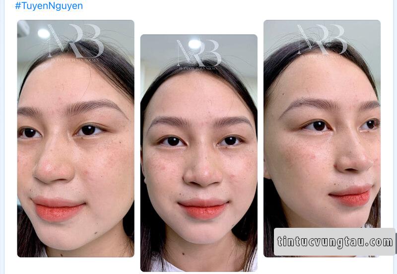 Rot Eyebrows & Beauty - Eyebrows By Tuyen Nguyen